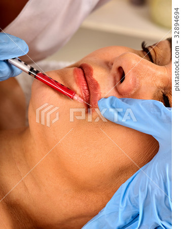 Filler injection female face. Plastic facial Filler injection female face. Plastic facial 32894694