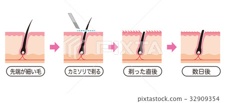 Cross section view of waste hair treatment razor hair 32909354