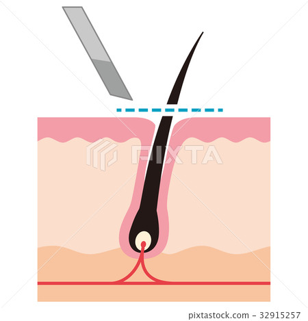 Cross section view of waste hair treatment razor hair 32915257