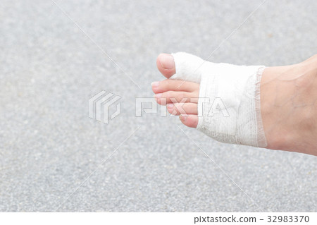 Injured feet with wounds.Wound on the foot of pati 32983370