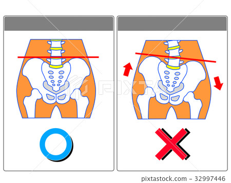 Comparison of pelvic distortion (normal, distortion) (gray, no words) 32997446