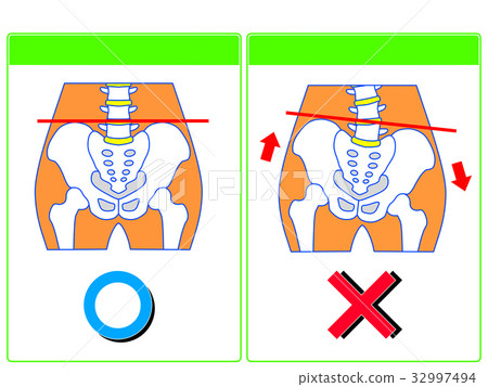 Comparison of pelvic distortion (normal, distortion) (green, no words) 32997494