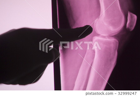Knee joint xray test scan Knee joint xray test scan 32999247