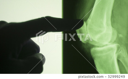 Knee joint xray test scan Knee joint xray test scan 32999249