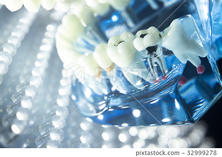 Dental teeth model root 32999278