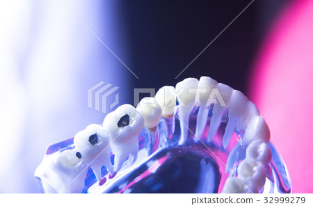 Dental tooth health decay Dental tooth health decay 32999279