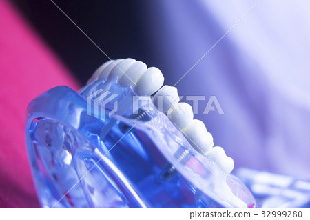 Dentists dental tooth model Dentists dental tooth model 32999280