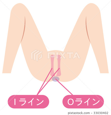 I-line O-line脫毛 I-line O-line脫毛 33030402