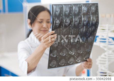 X ray image being examined by a doctor 33042098