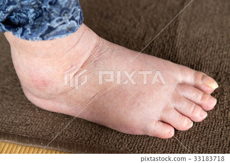 老人的腳 33183718