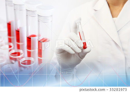 Medical and research image Blood test 33281973