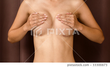The perfect shape of Asian women's breasts surgery 33300873