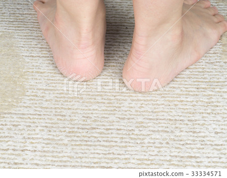 女腳後跟裂縫 女腳後跟裂縫 33334571