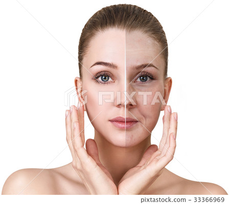 Woman's face before and after rejuvenation. 33366969
