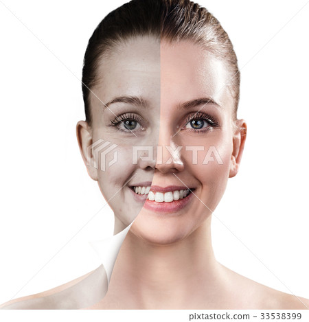 Woman's face before and after rejuvenation. 33538399