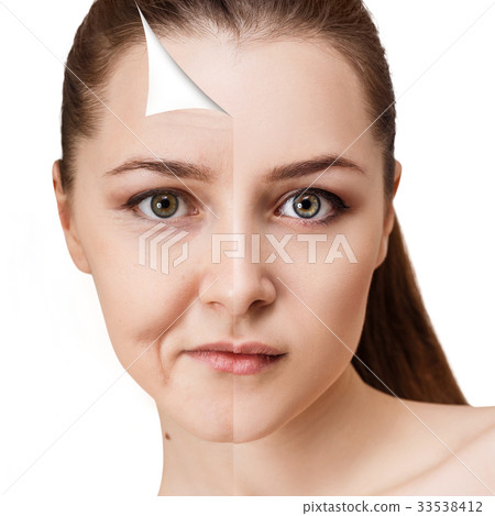Woman's face before and after rejuvenation. 33538412