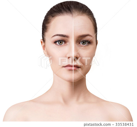 Woman's face before and after rejuvenation. 33538431