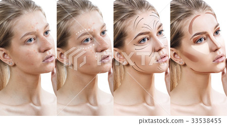 Woman step by step improves her skin condition. 33538455