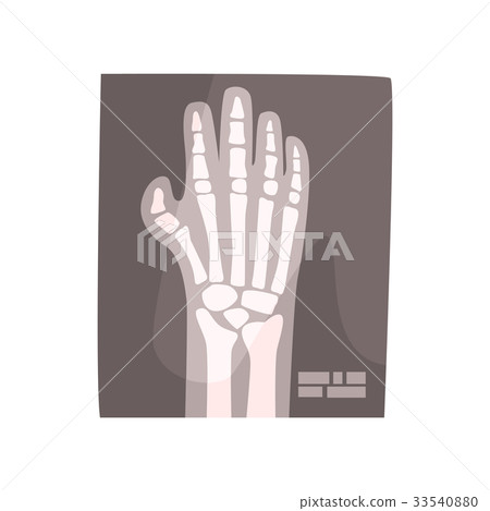 X ray image of human hand cartoon vector X ray image of human hand cartoon vector 33540880