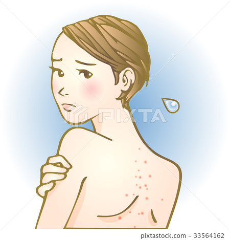 Trouble skin girl 33564162