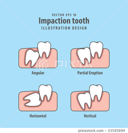 Impaction tooth illustration vector on blue 33585694