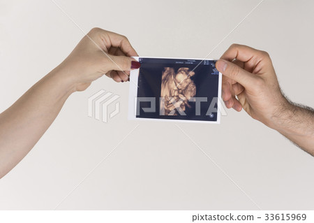 Parent holding unborn baby sonography image 33615969