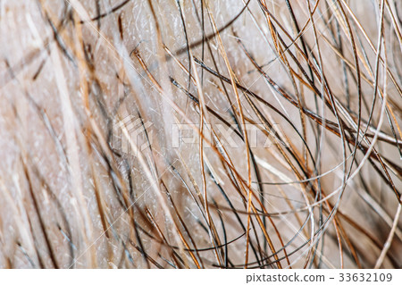 Male beard hair 33632109