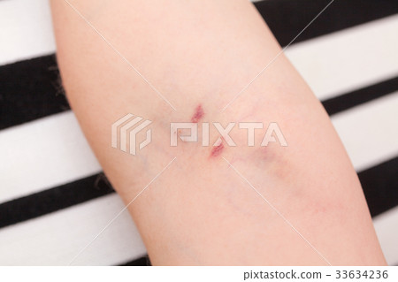 Medical issue 33634236