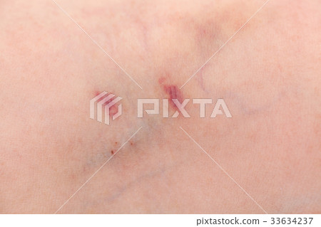 Medical issue Medical issue 33634237