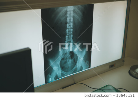 射線掃描 x光透射片 諮詢室 33645151