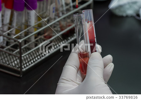 Pipette dropping a sample in test tube 33769816