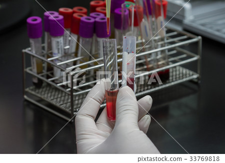 Pipette dropping a sample in test tube Pipette dropping a sample in test tube 33769818