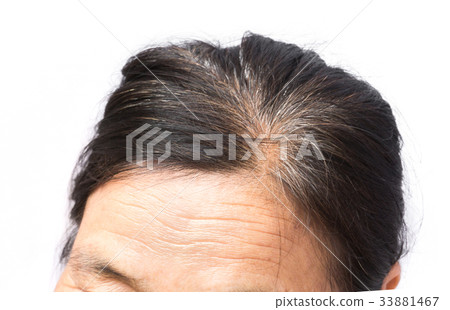 Wrinkles on forehead and grey hair old woman Wrinkles on forehead and grey hair old woman 33881467