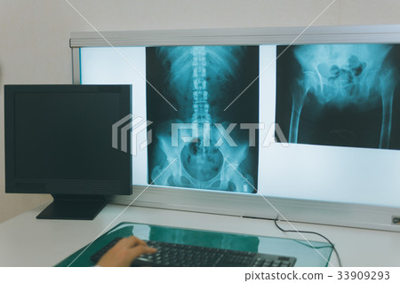 x-ray photo, consultation room, diagnosis 33909293
