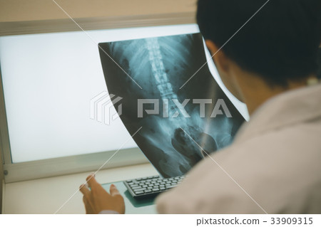 roentgen, x-ray scan, x-ray photo 33909315