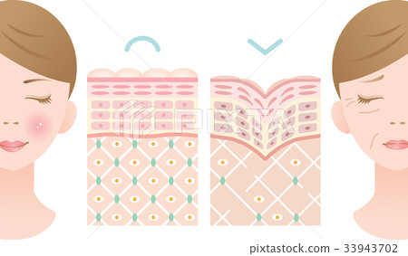 Young skin wrinkle skin cross section Young skin wrinkle skin cross section 33943702