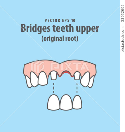 Bridges teeth upper (original root) vector 33952693