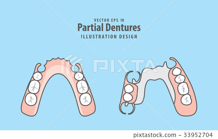 Partial Dentures illustration vector. 33952704