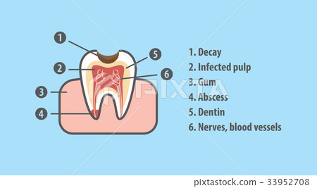 Structure of tooth illustration vector Structure of tooth illustration vector 33952708
