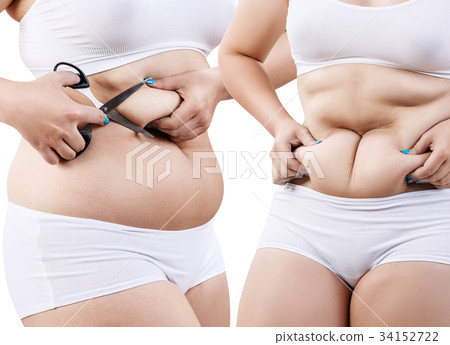 Collage of fat woman holds abdominal folds 34152722