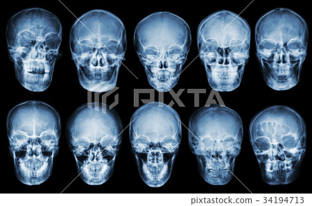 Collection of asian skull . front view  . 34194713