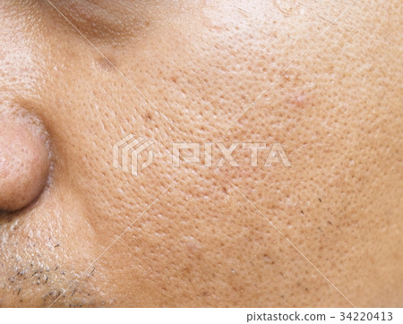 pores and oily on face skin young asian man  34220413