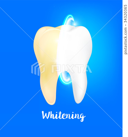 Cleaning dirty tooth on blue background. 34320365