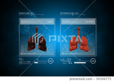Young doctor showing lungs Young doctor showing lungs 34348775