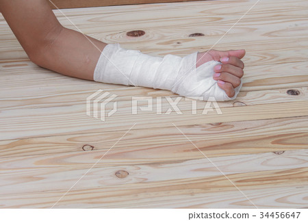 Gauze bandage On hand contusion.treating patients Gauze bandage On hand contusion.treating patients 34456647