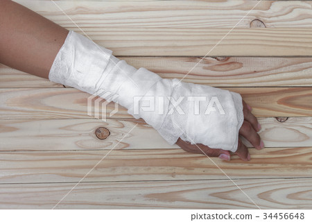 Gauze bandage On hand contusion.treating patients Gauze bandage On hand contusion.treating patients 34456648