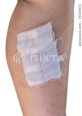 bandage on leg from Horrible burns 34504631