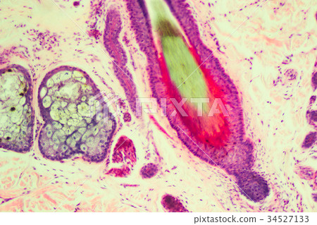 髮根 髮根 34527133