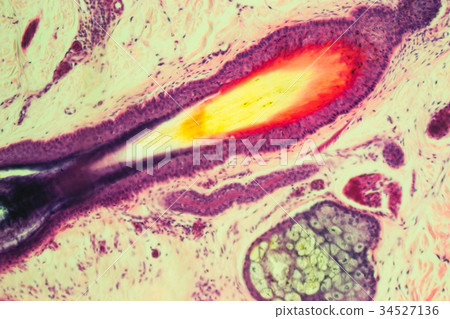 Hair roots Hair roots 34527136