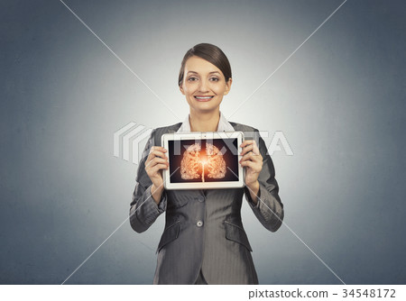 X-ray of lungs 34548172